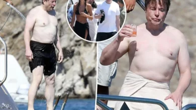 Why is Elon Musk so Lumpy and Ugly?