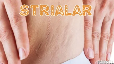 Strialar (Stretch Marks) – The Complete 2026 US Guide to Causes